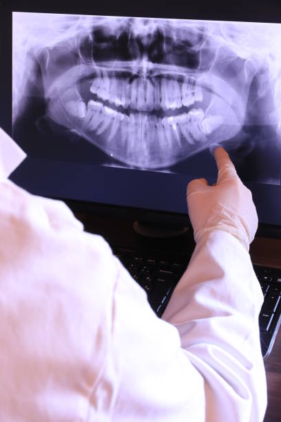 Best Root Canal Emergency Dentist  in Lyman, WY